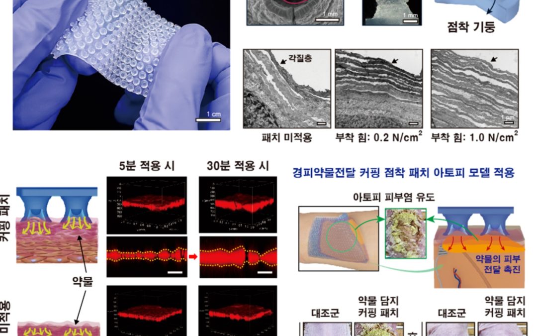 성균관대 “문어 빨판 원리로 피부에 약물 전달”